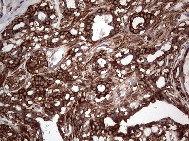 PKM2 Antibody in Immunohistochemistry (Paraffin) (IHC (P))