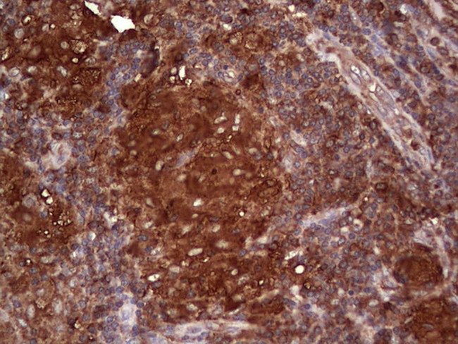 PKM2 Antibody in Immunohistochemistry (Paraffin) (IHC (P))