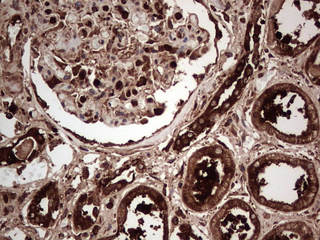 PKM2 Antibody in Immunohistochemistry (Paraffin) (IHC (P))