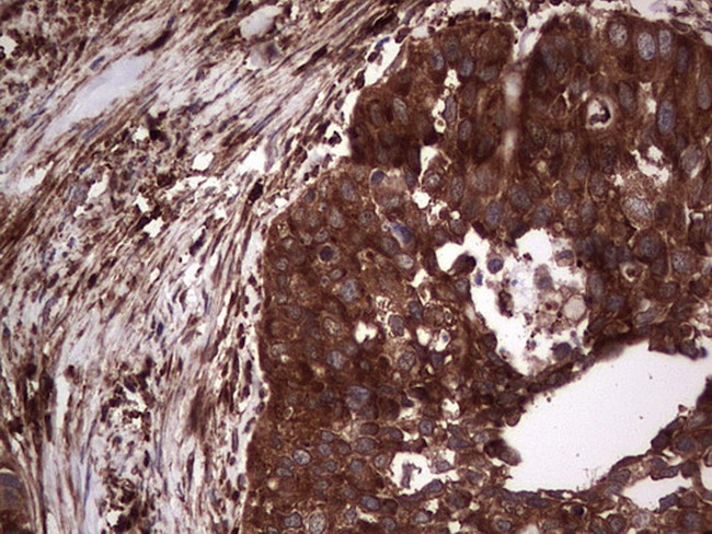 PKM2 Antibody in Immunohistochemistry (Paraffin) (IHC (P))