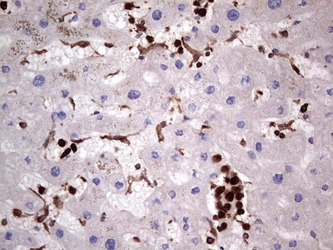 PKM2 Antibody in Immunohistochemistry (Paraffin) (IHC (P))