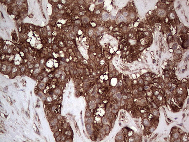 PKM2 Antibody in Immunohistochemistry (Paraffin) (IHC (P))