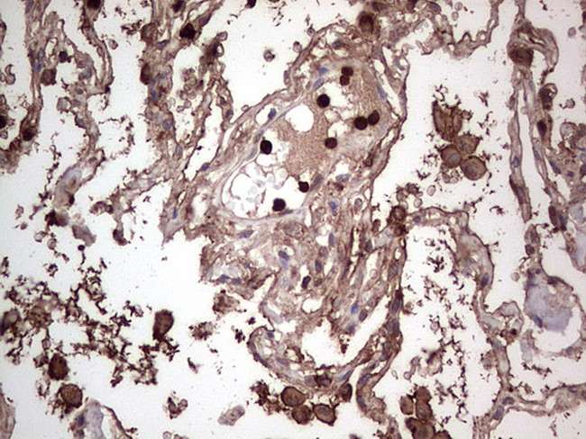 PKM2 Antibody in Immunohistochemistry (Paraffin) (IHC (P))