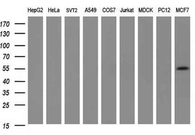 PKM2 Antibody in Western Blot (WB)