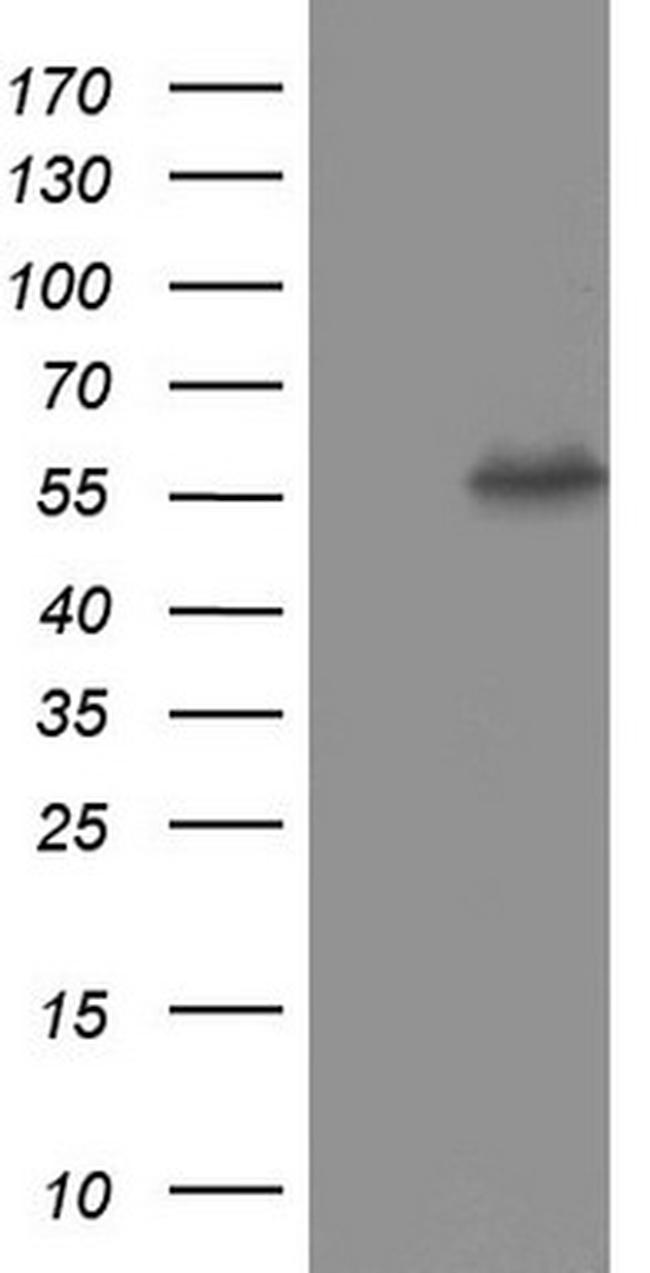 PKM2 Antibody in Western Blot (WB)