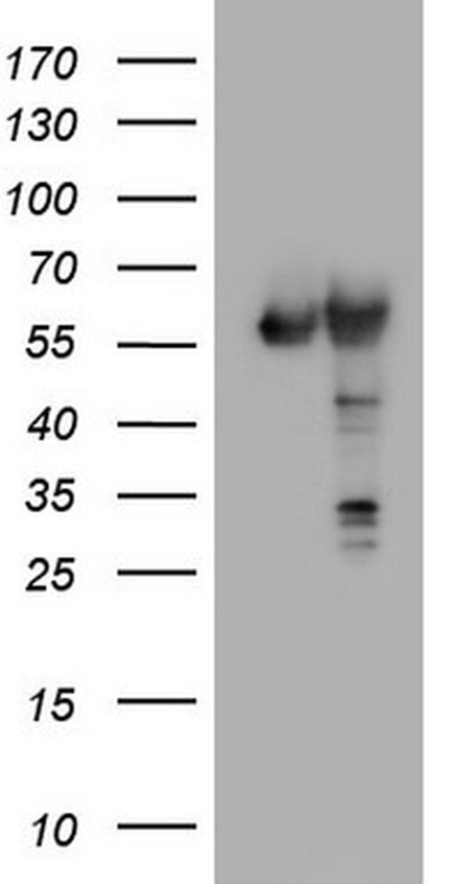 PKM2 Antibody in Western Blot (WB)