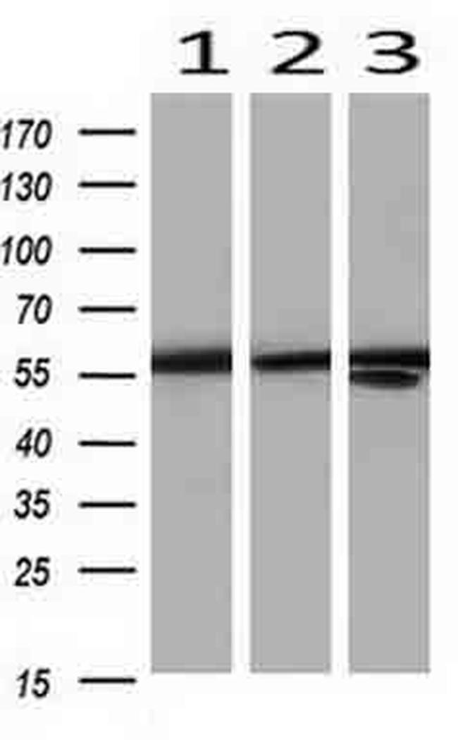 PKM2 Antibody in Western Blot (WB)