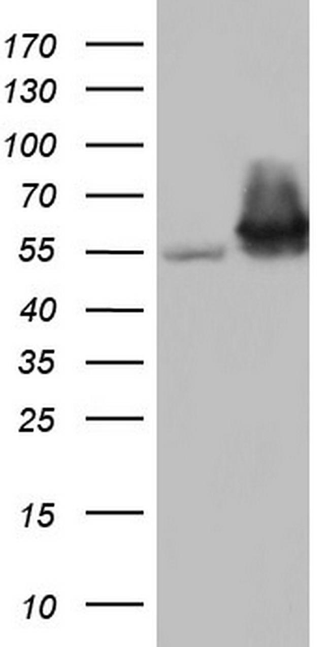 PKM2 Antibody in Western Blot (WB)