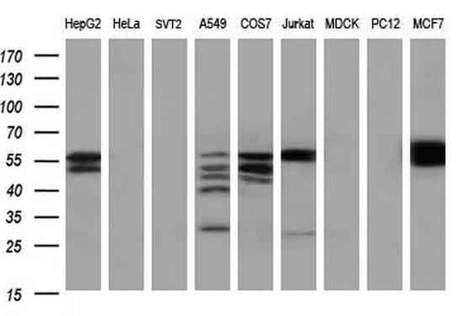 PKM2 Antibody in Western Blot (WB)