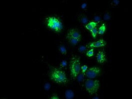 PKMYT1 Antibody in Immunocytochemistry (ICC/IF)