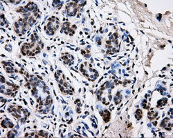 PKMYT1 Antibody in Immunohistochemistry (Paraffin) (IHC (P))