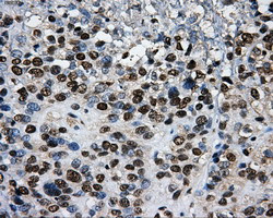 PKMYT1 Antibody in Immunohistochemistry (Paraffin) (IHC (P))