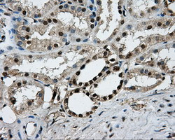 PKMYT1 Antibody in Immunohistochemistry (Paraffin) (IHC (P))