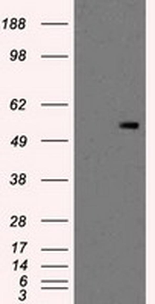 PKMYT1 Antibody in Western Blot (WB)