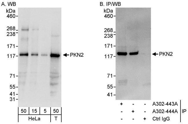 PKN2 Antibody in Western Blot (WB)