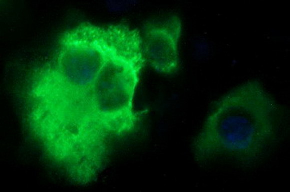 PLA2G16 Antibody in Immunocytochemistry (ICC/IF)