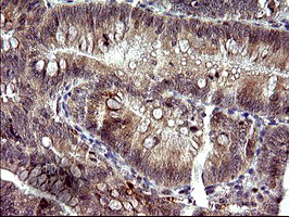 PLA2G16 Antibody in Immunohistochemistry (Paraffin) (IHC (P))