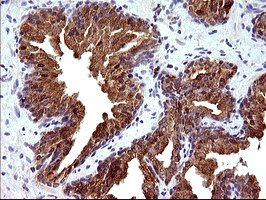 PLA2G16 Antibody in Immunohistochemistry (Paraffin) (IHC (P))