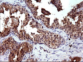 PLA2G16 Antibody in Immunohistochemistry (Paraffin) (IHC (P))