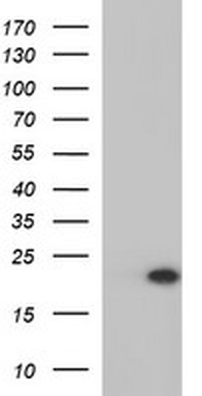 PLA2G16 Antibody in Western Blot (WB)