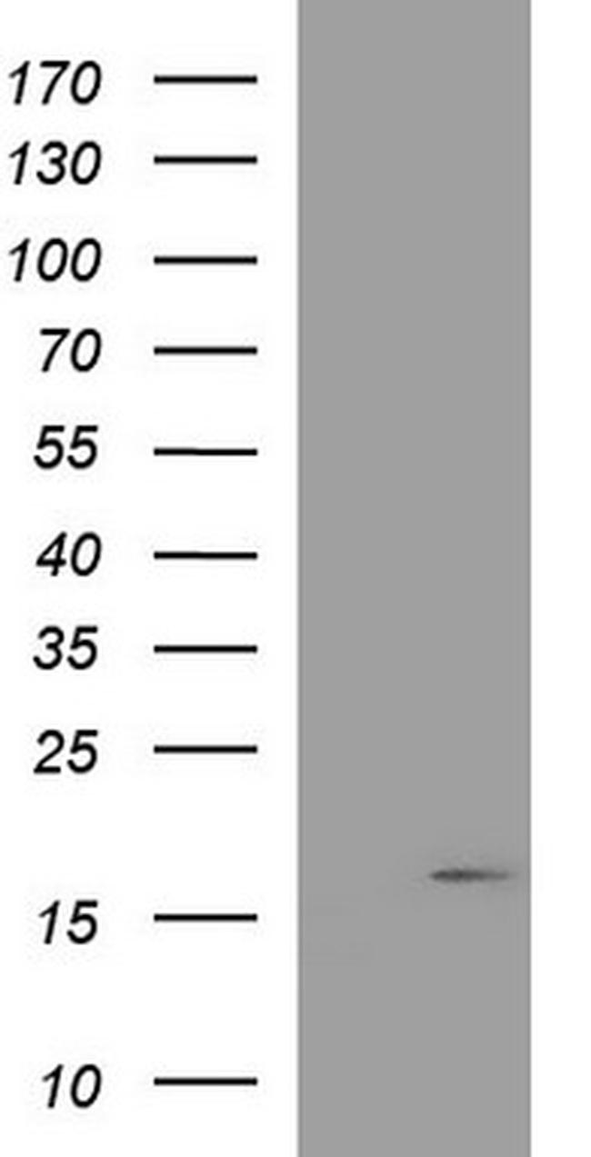 PLA2G16 Antibody in Western Blot (WB)