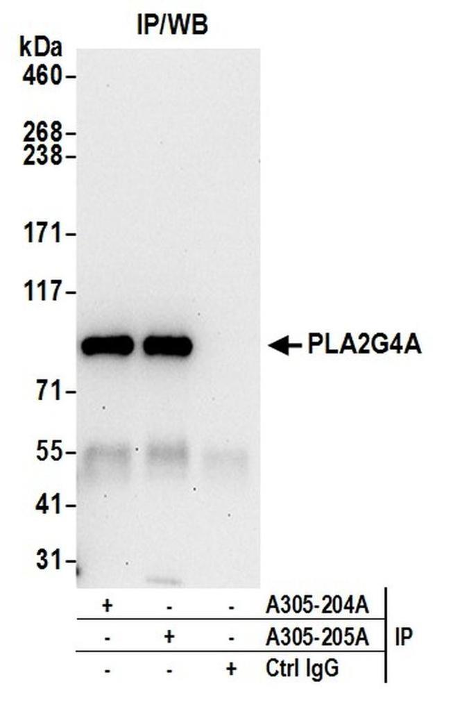 PLA2G4A/cPLA2 Antibody in Western Blot (WB)