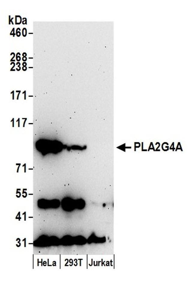 PLA2G4A/cPLA2 Antibody in Western Blot (WB)