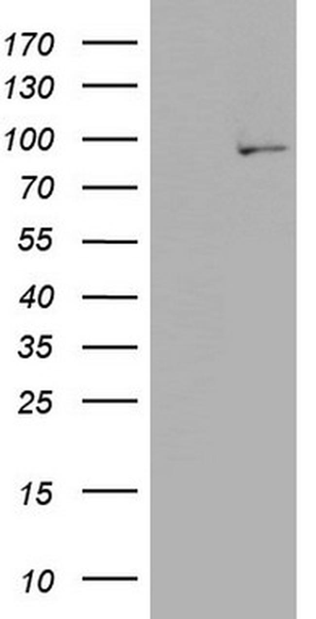 PLA2G6 Antibody in Western Blot (WB)