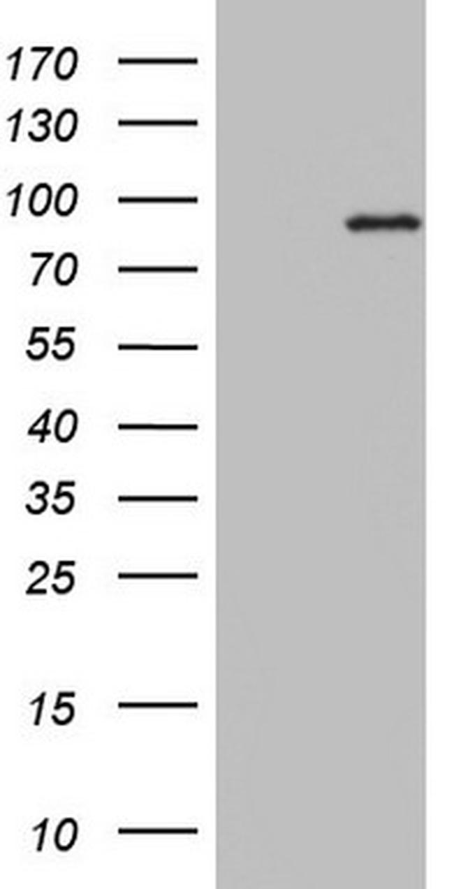 PLA2G6 Antibody in Western Blot (WB)