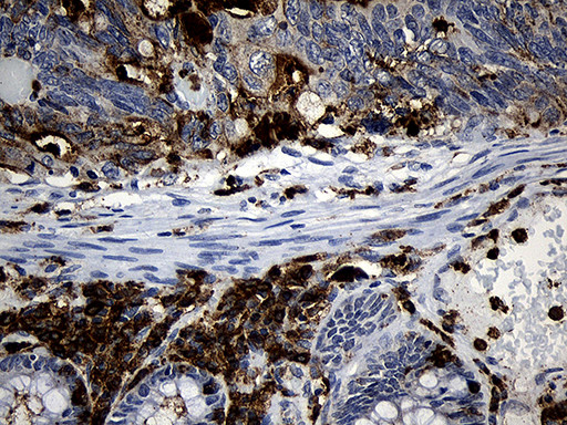 PLAC8 Antibody in Immunohistochemistry (Paraffin) (IHC (P))