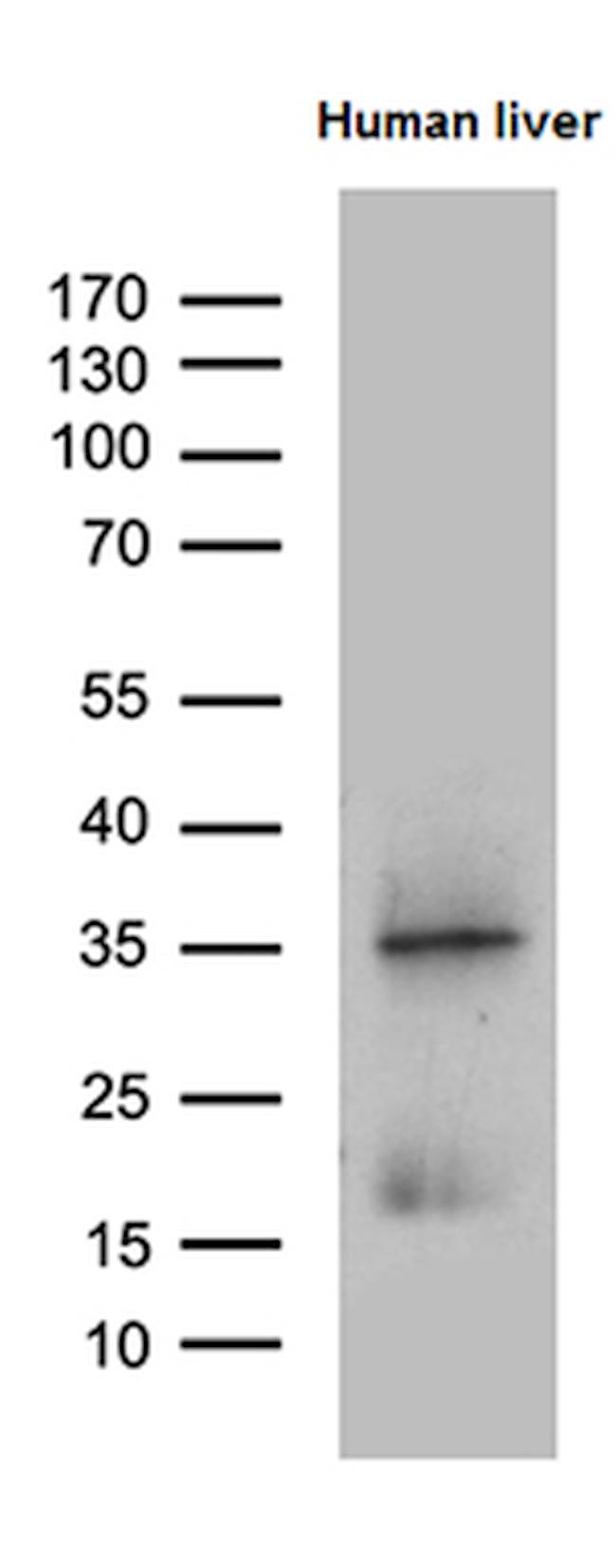 PLAC8 Antibody in Western Blot (WB)