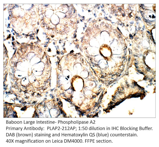 Phospholipase A2 Antibody in Immunohistochemistry (IHC)