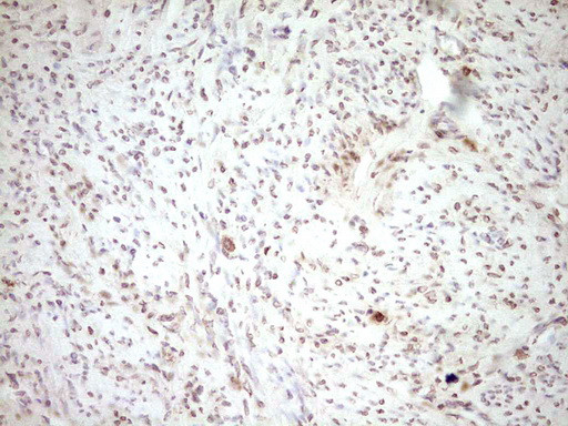 PLAT Antibody in Immunohistochemistry (Paraffin) (IHC (P))