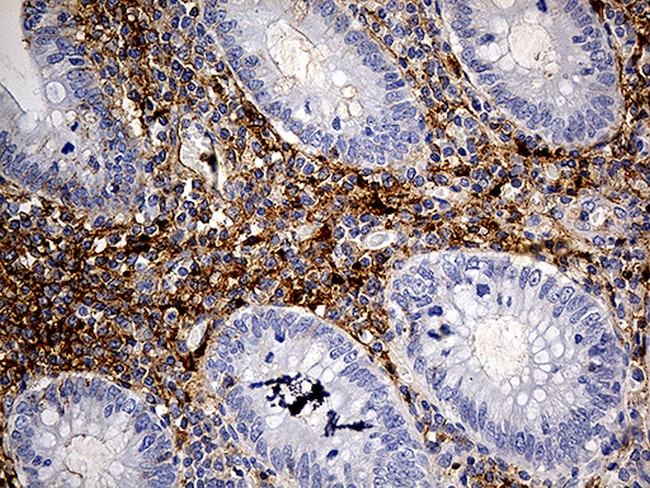 PLG Antibody in Immunohistochemistry (Paraffin) (IHC (P))