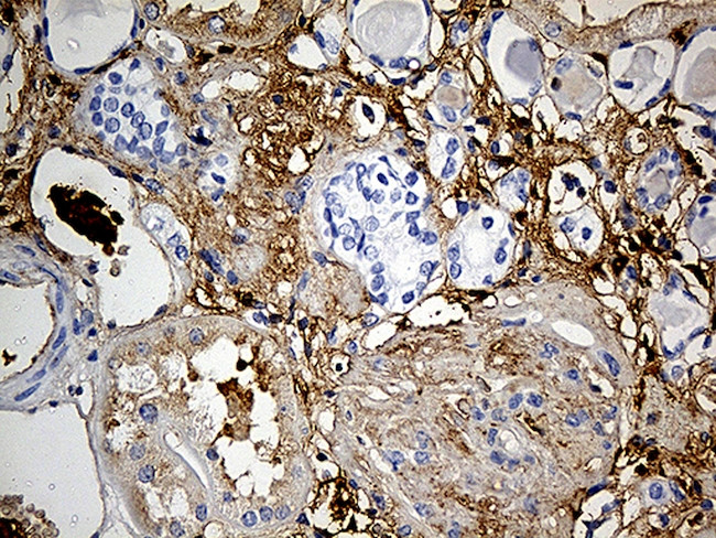 PLG Antibody in Immunohistochemistry (Paraffin) (IHC (P))