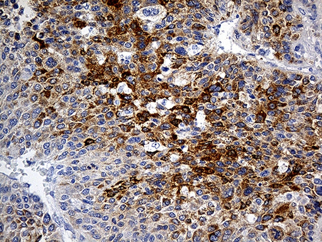 PLG Antibody in Immunohistochemistry (Paraffin) (IHC (P))