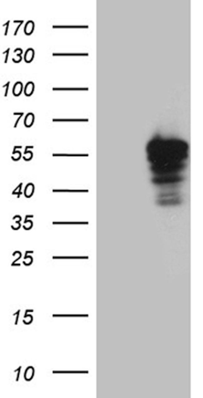 PLIN5 Antibody in Western Blot (WB)