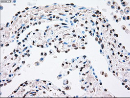 PLK1 Antibody in Immunohistochemistry (Paraffin) (IHC (P))