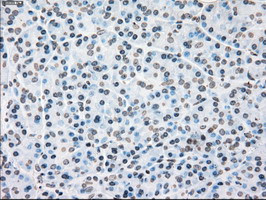 PLK1 Antibody in Immunohistochemistry (Paraffin) (IHC (P))