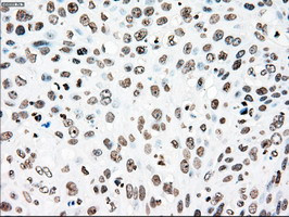 PLK1 Antibody in Immunohistochemistry (Paraffin) (IHC (P))