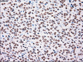 PLK1 Antibody in Immunohistochemistry (Paraffin) (IHC (P))