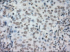 PLK1 Antibody in Immunohistochemistry (Paraffin) (IHC (P))