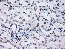 PLK1 Antibody in Immunohistochemistry (Paraffin) (IHC (P))