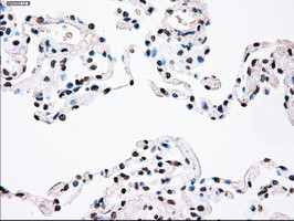 PLK1 Antibody in Immunohistochemistry (Paraffin) (IHC (P))