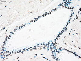 PLK1 Antibody in Immunohistochemistry (Paraffin) (IHC (P))