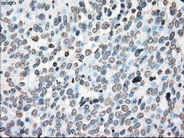 PLK1 Antibody in Immunohistochemistry (Paraffin) (IHC (P))