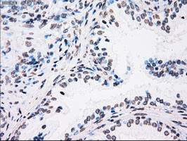 PLK1 Antibody in Immunohistochemistry (Paraffin) (IHC (P))