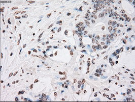 PLK1 Antibody in Immunohistochemistry (Paraffin) (IHC (P))