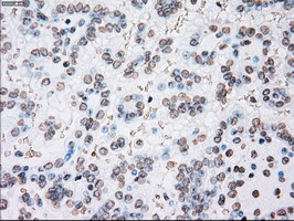 PLK1 Antibody in Immunohistochemistry (Paraffin) (IHC (P))