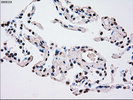 PLK1 Antibody in Immunohistochemistry (Paraffin) (IHC (P))